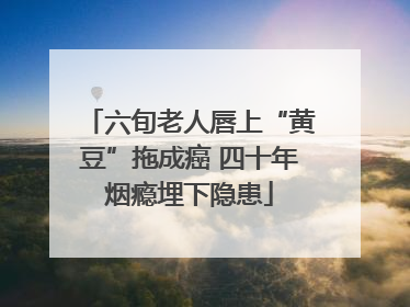 六旬老人唇上“黄豆”拖成癌 四十年烟瘾埋下隐患
